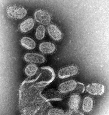 565px-EM_of_influenza_virus.jpg